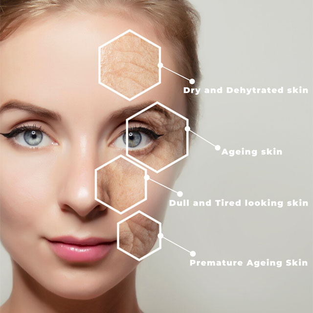Fix Dry, Ageing and Distressed Skin